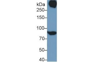 Detection of STAT3 in Rat Serum using Polyclonal Antibody to Signal Transducer And Activator Of Transcription 3 (STAT3)