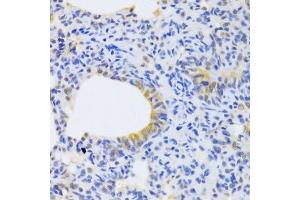 Immunohistochemistry of paraffin-embedded rat lung using MRPS30 Antibody.
