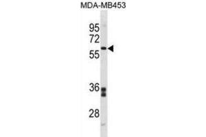 Western Blotting (WB) image for anti-Flavin Containing Monooxygenase 5 (FMO5) antibody (ABIN3001414)