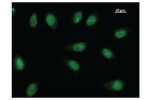 Immunostaining analysis in HeLa cells. (TEAD2 anticorps)