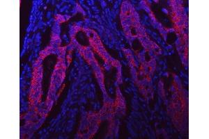 IF analysis of Syntaxin 18/STX18 using anti-Syntaxin 18/STX18 antibody (ABIN7599259). (Syntaxin 18 anticorps  (AA 1-313))