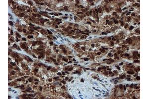 Image no. 11 for anti-Proteasome Subunit alpha 6 (PSMA6) antibody (ABIN1500464)