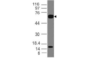 Image no. 1 for anti-Interleukin 1 Receptor-Like 2 (IL1RL2) (AA 1-203) antibody (ABIN5027303) (IL1RL2 anticorps  (AA 1-203))