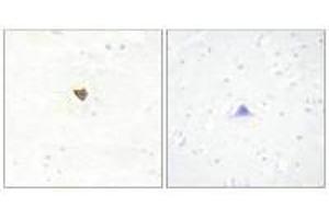 Immunohistochemistry analysis of paraffin-embedded human brain tissue using JKIP2 antibody.