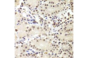Immunohistochemistry of paraffin-embedded human stomach using PRPF3 Antibody. (PRPF3 anticorps  (AA 1-280))