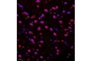 Immunohistochemistry of paraffin embedded rat brain using CDH19 (ABIN7073258) at dilution of 1:500 (400x lens)