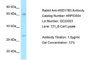 Western Blotting (WB) image for anti-Hydroxysteroid (17-Beta) Dehydrogenase 3 (HSD17B3) (N-Term) antibody (ABIN2785439) (HSD17B3 anticorps  (N-Term))