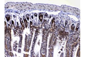 IHC analysis of Ran using anti-Ran antibody .