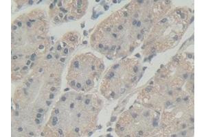 Detection of ABI1 in Human Stomach Tissue using Polyclonal Antibody to Abl Interactor 1 (ABI1)