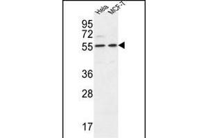 DDX6 Antibody (Center) (ABIN653855 and ABIN2843115) western blot analysis in Hela,MCF-7 cell line lysates (35 μg/lane). (DDX6 anticorps  (AA 348-375))