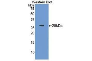 Detection of Recombinant ICAM4, Mouse using Polyclonal Antibody to Intercellular Adhesion Molecule 4 (ICAM4) (ICAM4 anticorps  (AA 23-227))