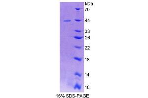 SDS-PAGE analysis of Mouse ERI1 Protein. (ERI1 Protéine)
