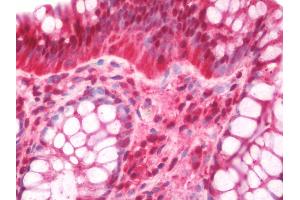 Human Colon: Formalin-Fixed, Paraffin-Embedded (FFPE).