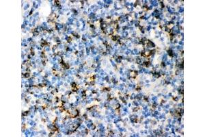 IHC-P: CD8 antibody testing of human tonsil tissue