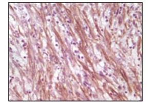 Immunohistochemistry (IHC) image for anti-Desmin (DES) antibody (ABIN1106977)