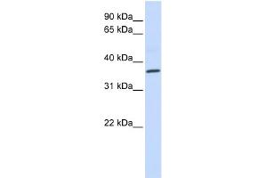 WB Suggested Anti-CCR5 Antibody Titration: 0. (CCR5 anticorps  (Middle Region))
