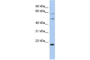 WB Suggested Anti-PSMC2 Antibody Titration:  0. (PSMC2 anticorps  (N-Term))