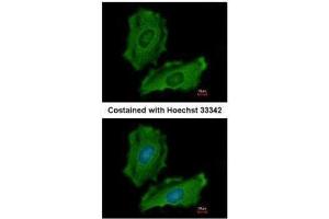 ICC/IF Image Immunofluorescence analysis of methanol-fixed HeLa, using PTPN12, antibody at 1:200 dilution. (PTPN12 anticorps  (N-Term))