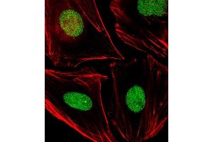 Immunofluorescent analysis of 4 % paraformaldehyde-fixed, 0.