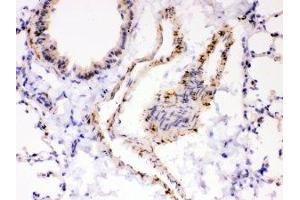 IHC-P: ATP2A2 antibody testing of mouse lung tissue