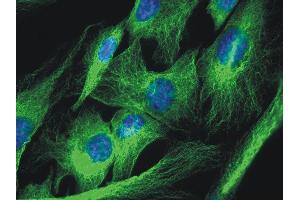 Nucleus is stained with DAPI (blue).