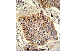Immunohistochemistry (IHC) image for anti-Golgi phosphoprotein 3 (Coat-Protein) (GOLPH3) antibody (ABIN3003212)