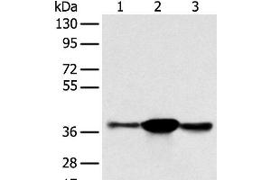Western blot analysis of K562 A375 and 231 cell using SPRY4 Polyclonal Antibody at dilution of 1:400