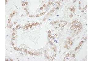 Immunohistochemistry (IHC) image for anti-Budding Uninhibited By Benzimidazoles 3 Homolog (Yeast) (BUB3) (AA 275-325) antibody (ABIN7448449)