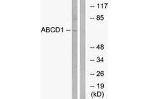 Western blot analysis of extracts from Jurkat cells, using ABCD1 Antibody.