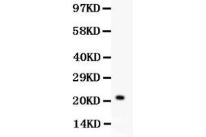 Western blot analysis of IL-18 expression in HELA whole cell lysates ( Lane 1). (IL-18 anticorps  (C-Term))