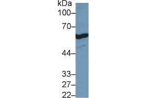 Detection of FOXP3 in Human Jurkat cell lysate using Polyclonal Antibody to Forkhead Box P3 (FOXP3) (FOXP3 anticorps  (AA 190-412))