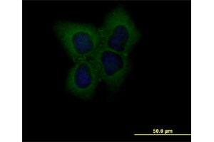 Immunofluorescence of monoclonal antibody to CLDN1 on Huh7 cell.