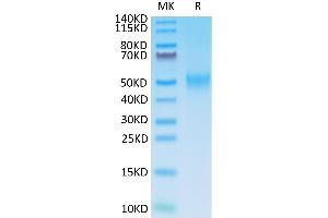 Mouse B7-1 on Tris-Bis PAGE under reduced condition. (CD80 Protein (CD80) (AA 38-246) (His tag))