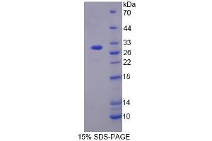 SDS-PAGE analysis of Human CACNa1S Protein.