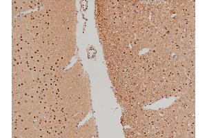 ABIN6267554 at 1/100 staining rat brain tissue sections by IHC-P.