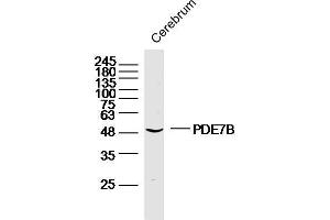 Mouse cerebrum lysates probed with PDE7B Polyclonal Antibody, unconjugated  at 1:300 overnight at 4°C followed by a conjugated secondary antibody at 1:10000 for 90 minutes at 37°C. (PDE7B anticorps  (AA 281-360))