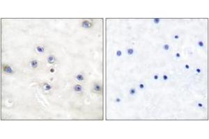 Immunohistochemistry analysis of paraffin-embedded human brain tissue, using COT (Ab-290) Antibody.