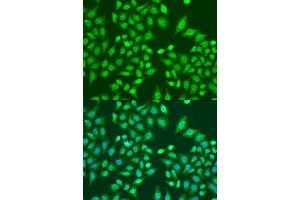 Immunofluorescence analysis of U2OS cells using PRPF8 antibody.
