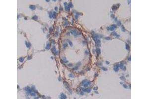 Used in DAB staining on fromalin fixed paraffin- embedded lung tissue (MCAM anticorps  (AA 323-560))