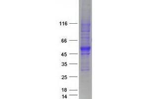 Validation with Western Blot