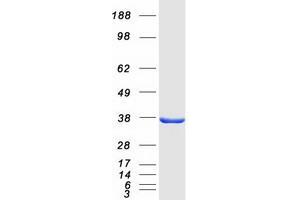 Validation with Western Blot