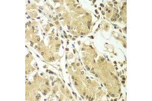 Immunohistochemistry of paraffin-embedded human stomach using BCAS3 antibody.