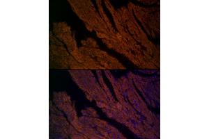 Immunofluorescence analysis of mouse heart cells using RYR2 Rabbit pAb (ABIN1513493, ABIN3020906, ABIN3020907 and ABIN6213787) at dilution of 1:200 (40x lens).