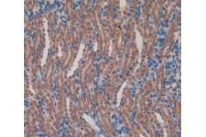 Used in DAB staining on fromalin fixed paraffin- embedded kidney tissue
