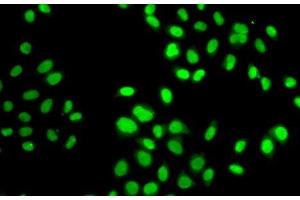 Immunofluorescence analysis of MCF7 cells using GPS1 Polyclonal Antibody (GPS1 anticorps)