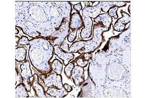 IHC analysis of Steroid Sulfatase/STS using anti-Steroid Sulfatase/STS antibody (ABIN7601166). (STS anticorps  (AA 297-547))