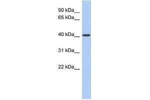 WB Suggested Anti-LASS5 Antibody Titration:  0. (LASS5 anticorps  (N-Term))