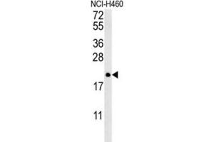 Western Blotting (WB) image for anti-Protein tyrosine Phosphatase Type IVA, Member 2 (PTP4A2) antibody (ABIN3002826) (PTP4A2 anticorps)