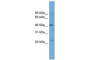 WB Suggested Anti-ATP8B2 Antibody Titration:  0. (ATP8B2 anticorps  (N-Term))