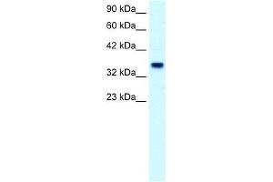 Human Placenta; WB Suggested Anti-FOXF1 Antibody Titration: 2. (FOXF1 anticorps  (C-Term))
